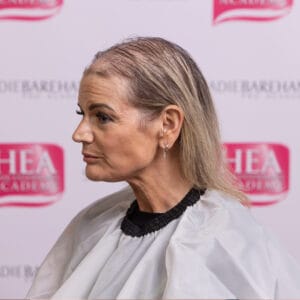 Replica Scalp Course